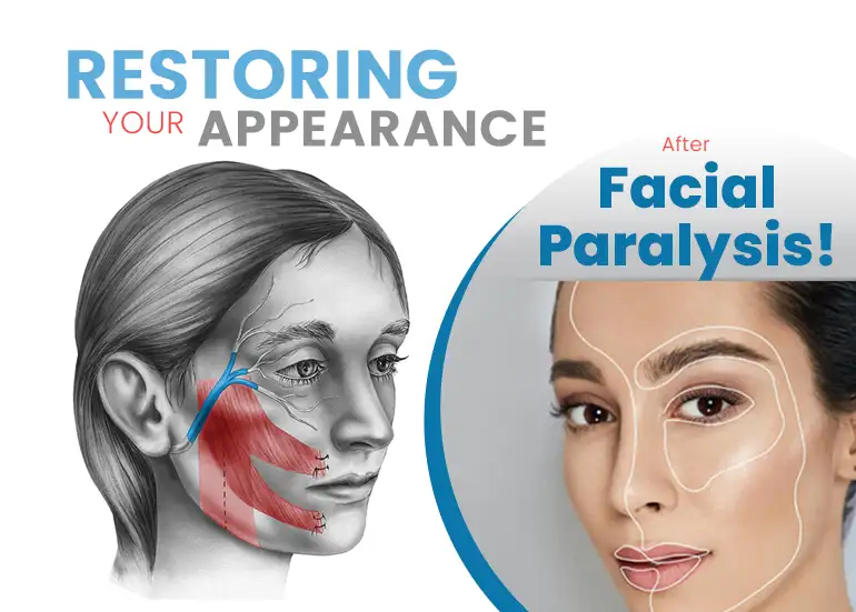 Restoring Your Appearance After Facial Paralysis! - Dr PR Bhuyan